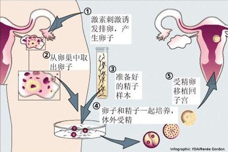 42岁成功案例